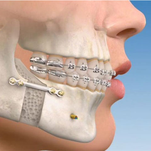 orthodontics