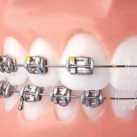 implantlogy